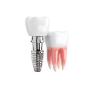 Implante Dental YaloMedical OsseoPlus™
